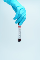 Obraz premium Hand with blue glove holding blood test tube samples of coronavirus (COVID-19).