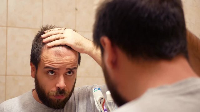 Man looking in the mirror and checking his damaged hair. Sad man with hair losss problems.