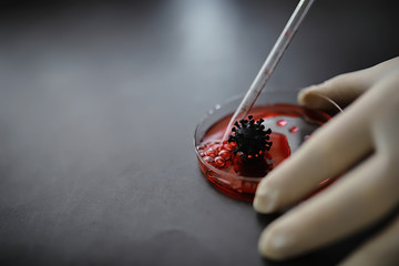 Test tube with patient blood for testing. Analysis for the virus. Coronavirus pandemic laboratory studies. Vaccine development.