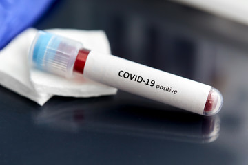 medicine, healthcare and pandemic concept - close up of beaker with positive coronavirus blood test on table at laboratory