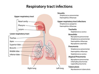 Human respiratory system with description of the corresponding parts. Respiratory tract infections of upper and lower respiratory tracts. Anatomical vector illustration in flat style. - obrazy, fototapety, plakaty