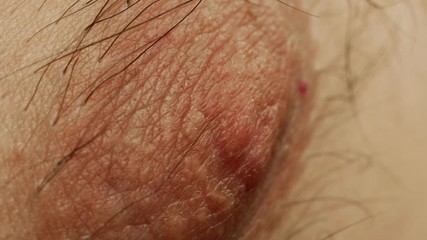 Male nipple close-up. The concept of plastic surgery on the male chest in men, background, macro, size