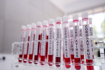 Focus one blood sample in the tube. 
Close-Up on Covid 19 blood tube for Vaccine research in Laboratory on background of Scientific Lab.
