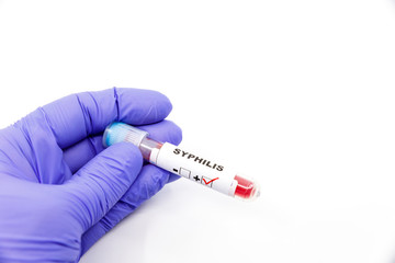 Closeup of microbiologist or medical worker hand with blue surgical gloves marking blood test result as positive for the syphilis. Syphilis Positive concept