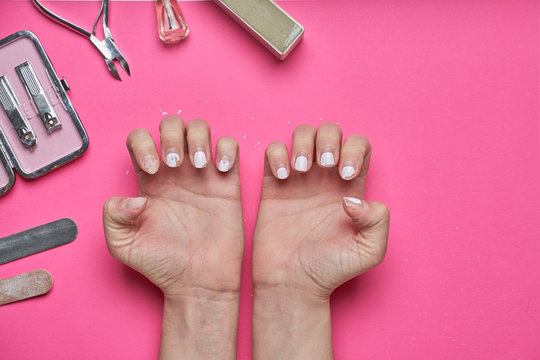 Overgrown Nails With An Old Cracked Gel Polish. Self-removal Of Old Gel Polish From Nails With A Nail File.