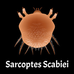 Sarcoptes scabiei. scabies. Sexually transmitted disease. Infographics. illustration on isolated background.