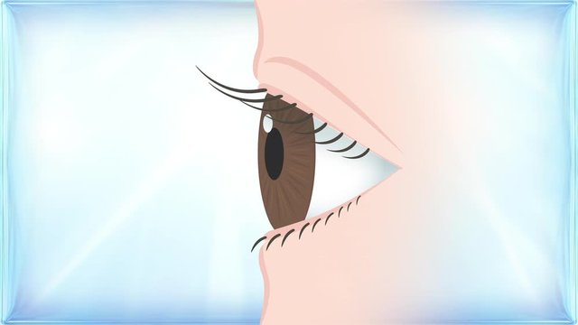 ドライアイ炎症イラストCG