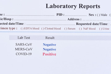 Positive test result of COVID-19 virus, novel coronavirus pandemic disease in 2020