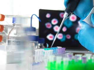Pharmaceutical research into infectious disease and pandemics, scientist pipetting a sample of a new drug formula into a vial during a clinical trial with the infectious disease on the computer screen