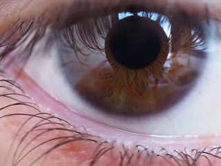 Eye