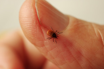 A parasitic tick on a person’s finger