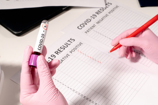 The doctor in pink medical gloves holds a test tube in his hand with a positive test result for COVID-19 and notes in the report of positive patients