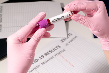Doctor in pink medical gloves holds test tubes with blood for analysis of virus COVID-19