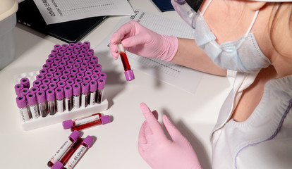 Fototapeta premium The doctor is holding a test tube with the analysis of CHOVID-19 next to a large assay with blood on the table in the hospital