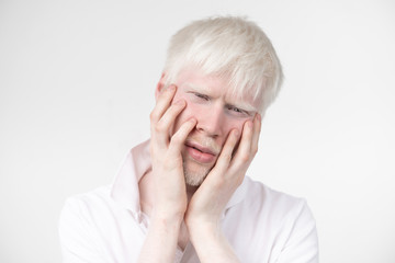 portrait of an albino man in  studio dressed t-shirt isolated on a white background. abnormal...