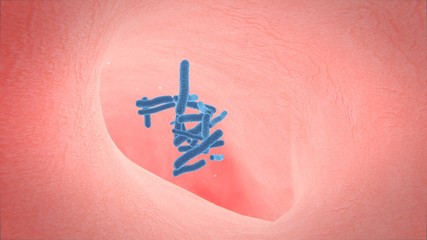 3d illustration of human lung structure.pneumonia.tuberculosis