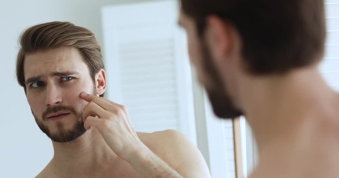 Unhappy young handsome man looking in bathroom mirror feeling worried about facial skin problem. Anxious millennial guy touching face frustrated by blackheads, acne. Men skincare treatment concept.