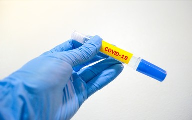 Hand wearing blue rubber nitride glove holding a tube of test result for the new rapidly spreading Coronavirus.Test tube with covid-19 word.