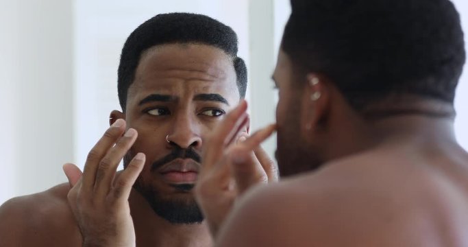 Young african man looking in mirror having facial skin problem. Worried ethnic hipster guy touching face stressed about acne, dry oily skin pigmentation. Male skincare dermatology treatment concept.