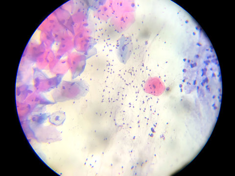 Microscopic image of cytological examination of the female genital system