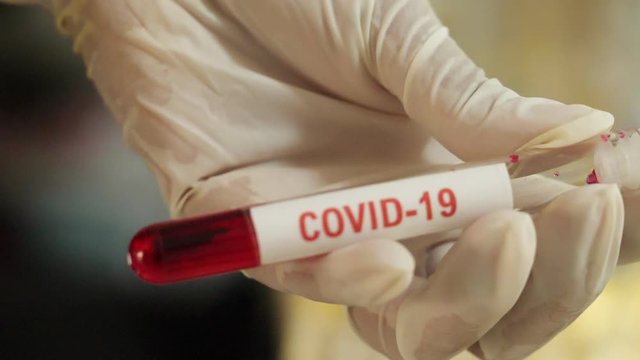 Doctor wearing white gloves holding test tube,  In there, the blood that was examined for the covid-19 virus .