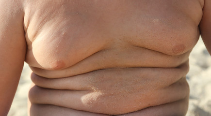 Fototapeta premium Folds on the belly of a fat boy.