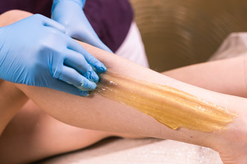 Sugaring epilation skin care with liquid sugar at legs close-up. You can see her smooth and hair free legs after hair removal. Beauty and cosmetology concept.