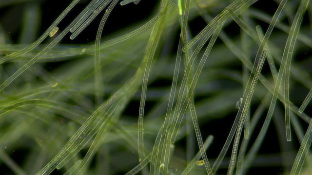 Green algae of the cyanobacteria Oscillatoria under the microscope, the family Oscillatoriaceae, the threads in the colonies can slide and move to the light source for photosynthesis. It is believed t