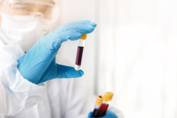 Researchers test blood samples in the laboratory. Researchers are inventing vaccines to treat COVID-19 virus.