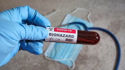 Doctor holding coronavirus covid 19 infected blood sample. covid-19 positive test.