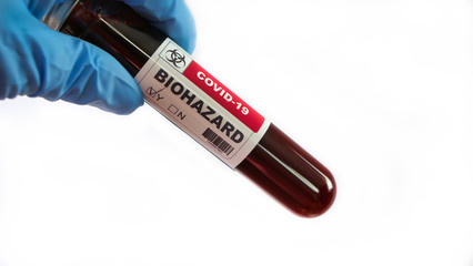Obraz premium Doctor holding coronavirus covid 19 infected blood sample. covid-19 positive test.