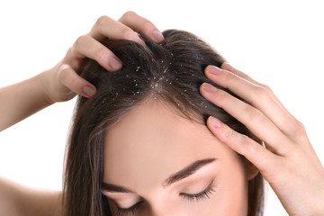 Woman with dandruff in her hair on white background, closeup