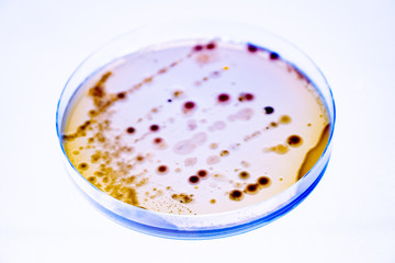 Mixed of bacteria colonies and fungus in various petri dish
