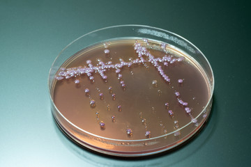 bacterial colonies   on  agar   medium petri dish plate plate on MacConkey agar