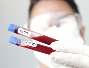 Laboratory assistant holding test tube of covid-19 virus