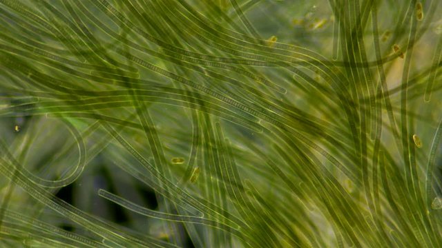 Green algae of the cyanobacteria Oscillatoria under the microscope, the family Oscillatoriaceae, the threads in the colonies can slide and move to the light source for photosynthesis. It is believed t