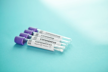 Patient sample of corona virus. Blood testing tubes. Coronavirus covid 19.