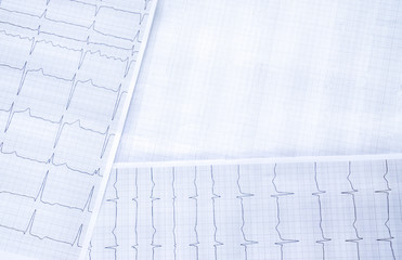 shetts of cardiogram lay on table medicine concept. place for text