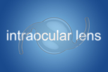 intraocular lens iol cataract ophthalmology