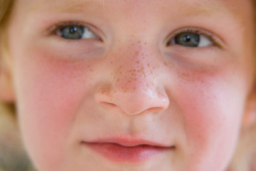 Gesicht eines Mädchens mit Sommersprossen 