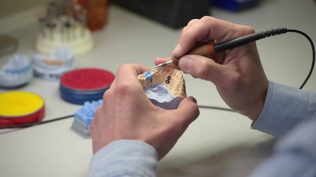 Close-up of a dental technician holding a tooth model in his hands and working with wax to create dentures in a laboratory