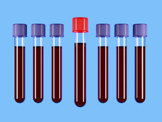 A row of test tubes with blood samples on the blue medical background. The one with a red top stands out among the others