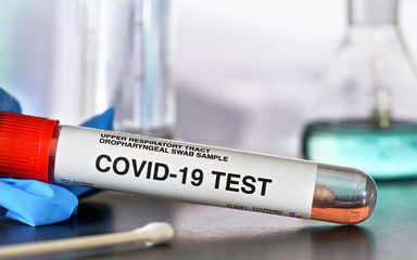 Fototapeta premium Coronavirus test concept - vial sample tube with cotton swab, blue gloves near, blurred lab glass background, closeup detail. (Sticker is own design with dummy data, not real product)