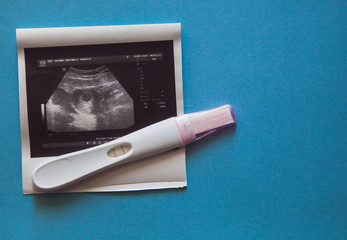 Ultrasound scan of an unborn baby of fifth week with a pregnancy test and calendar on the blue...