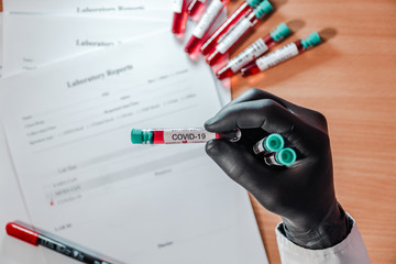 The doctor holds medical test tubes with blood tests for coronavirus in his black-gloved hand. Near are the laboratory results of tests and tubes with blood tests.