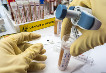 Experienced laboratory scientist analyzing a fecal sample, botulism infection in sick people,...