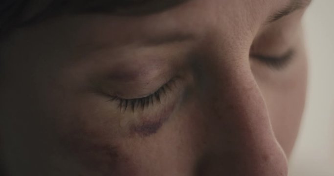 Woman is a victim of domestic violence terror physical abuse full of bruises cry tears during quarantine confinement coronavirus covid 19 pandemic extreme close up