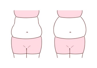 皮下脂肪　内臓脂肪