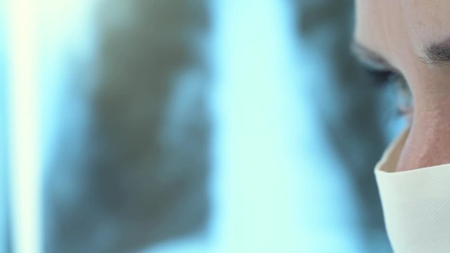 A doctor looks at radiographs of a patient with pneumonia
