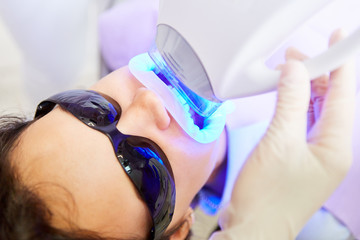 Blaues LED Licht bei professioneller Zahnaufhellung